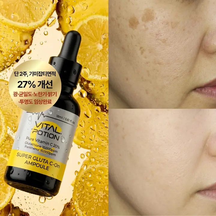 바이탈포션 슈퍼 글루타씨온 앰플, 18ml, 1개
